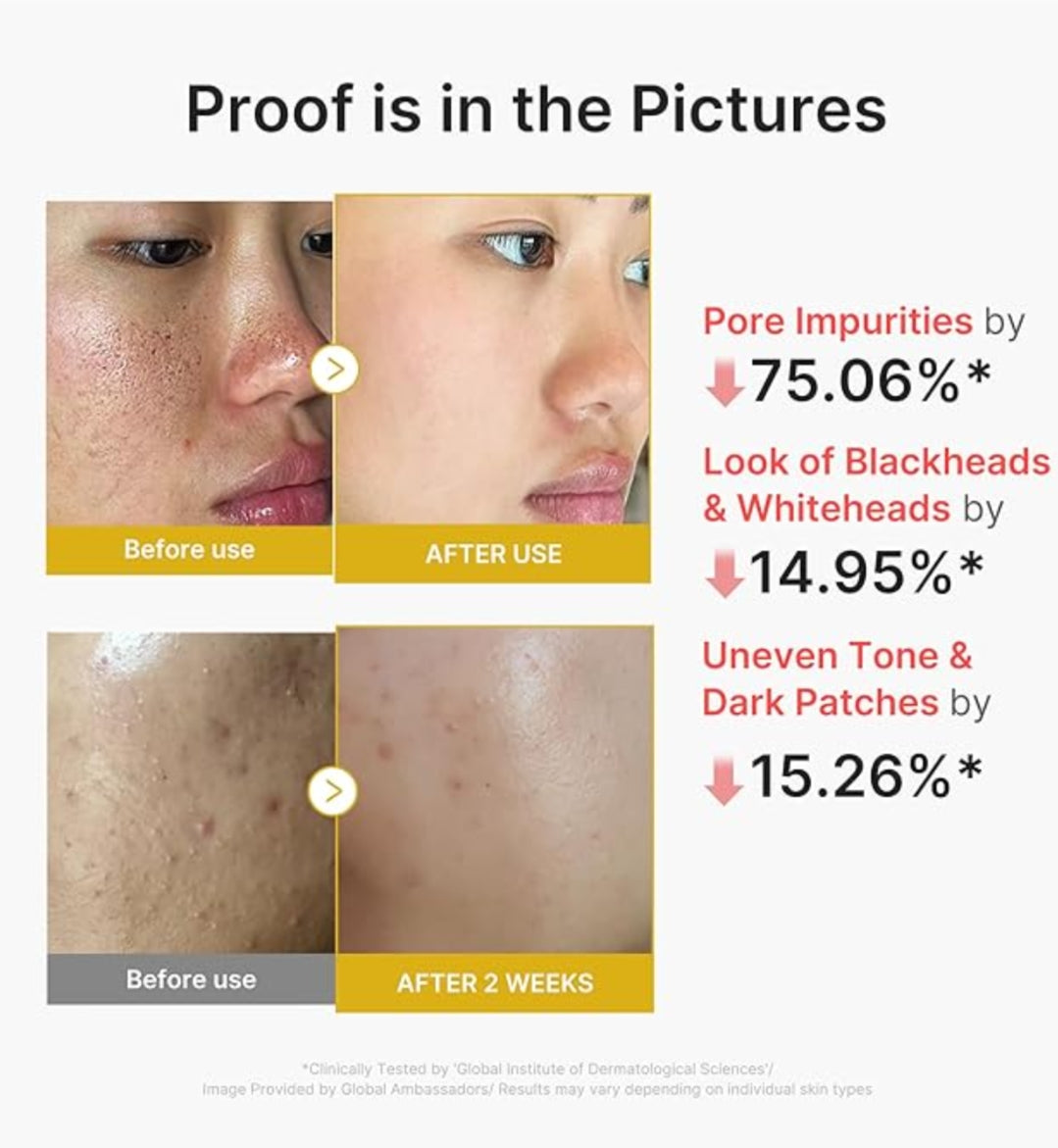 medicube kojic acid turmeric peel shot 80ml